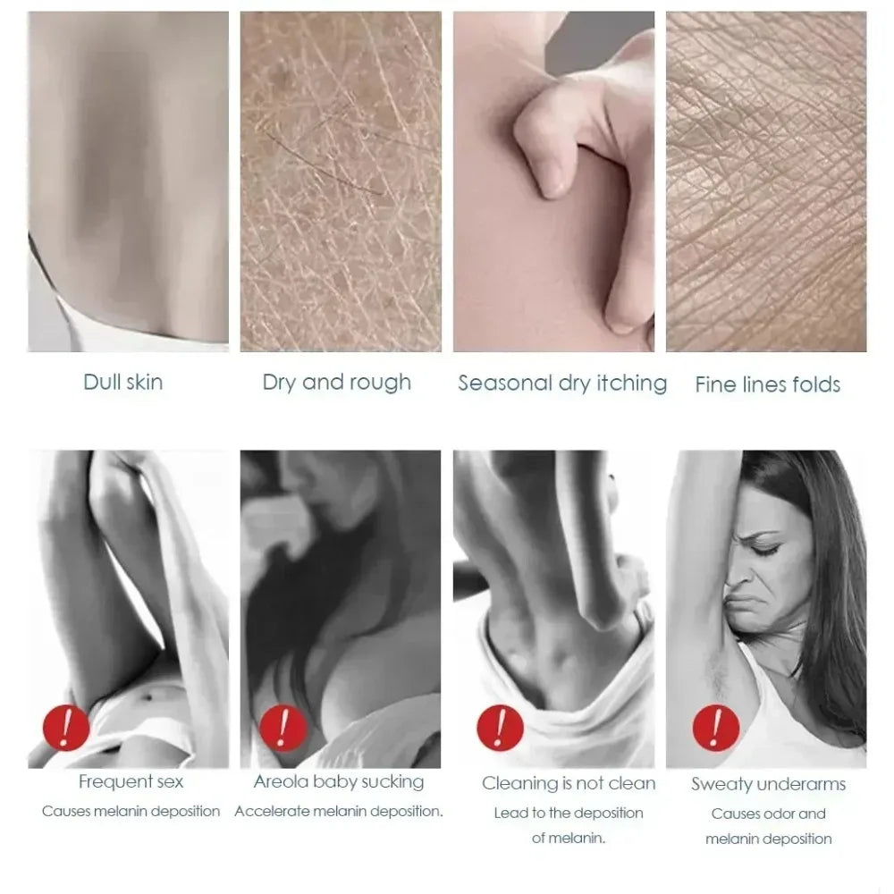 Niacinamide Body Whitening Cream For Underarm Bleaching Armpit Lightening Intimate Area Moisturizer Korean Skin Care Product