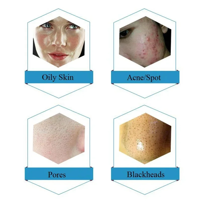 Dermabrasion Facial Serum - Hydrating Deep Cleansing 50ml Treatment Scrubs Treatments Tidesmit