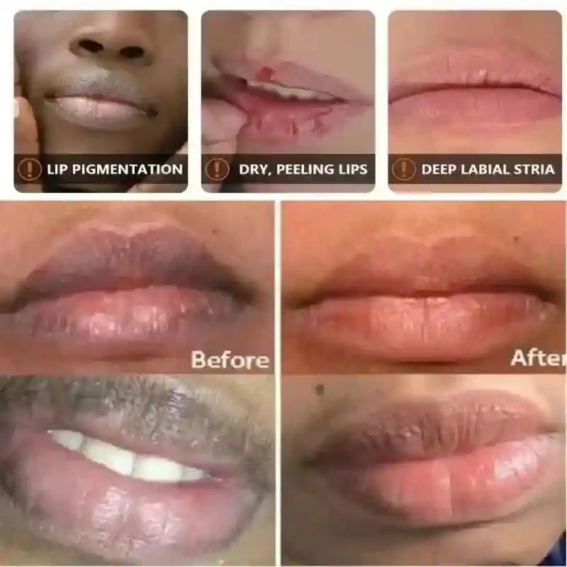 Dark Lip Lightening Serum & Niacinamide Exfoliating Lip Mask Lip Care Tidesmit