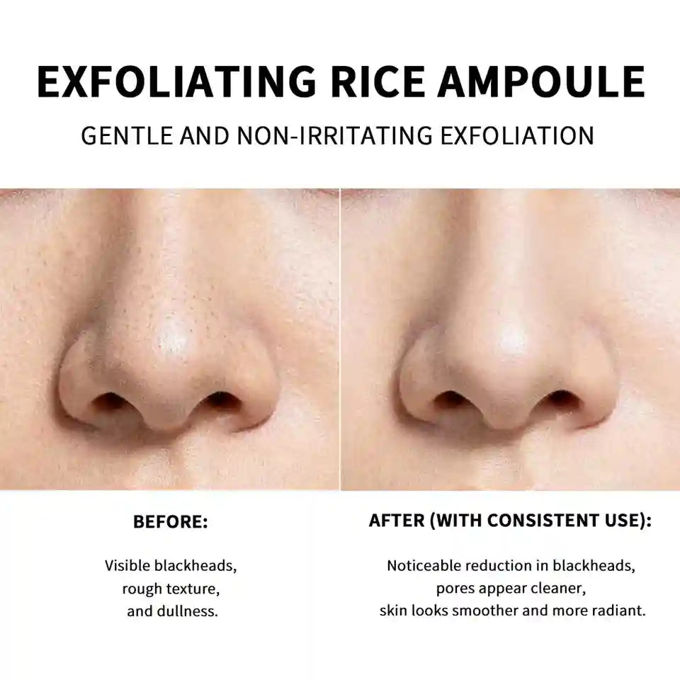 Rice Exfoliating Face Scrub for Clear Skin | Blackhead Remover | Tidesmit Scrubs Treatments Tidesmit