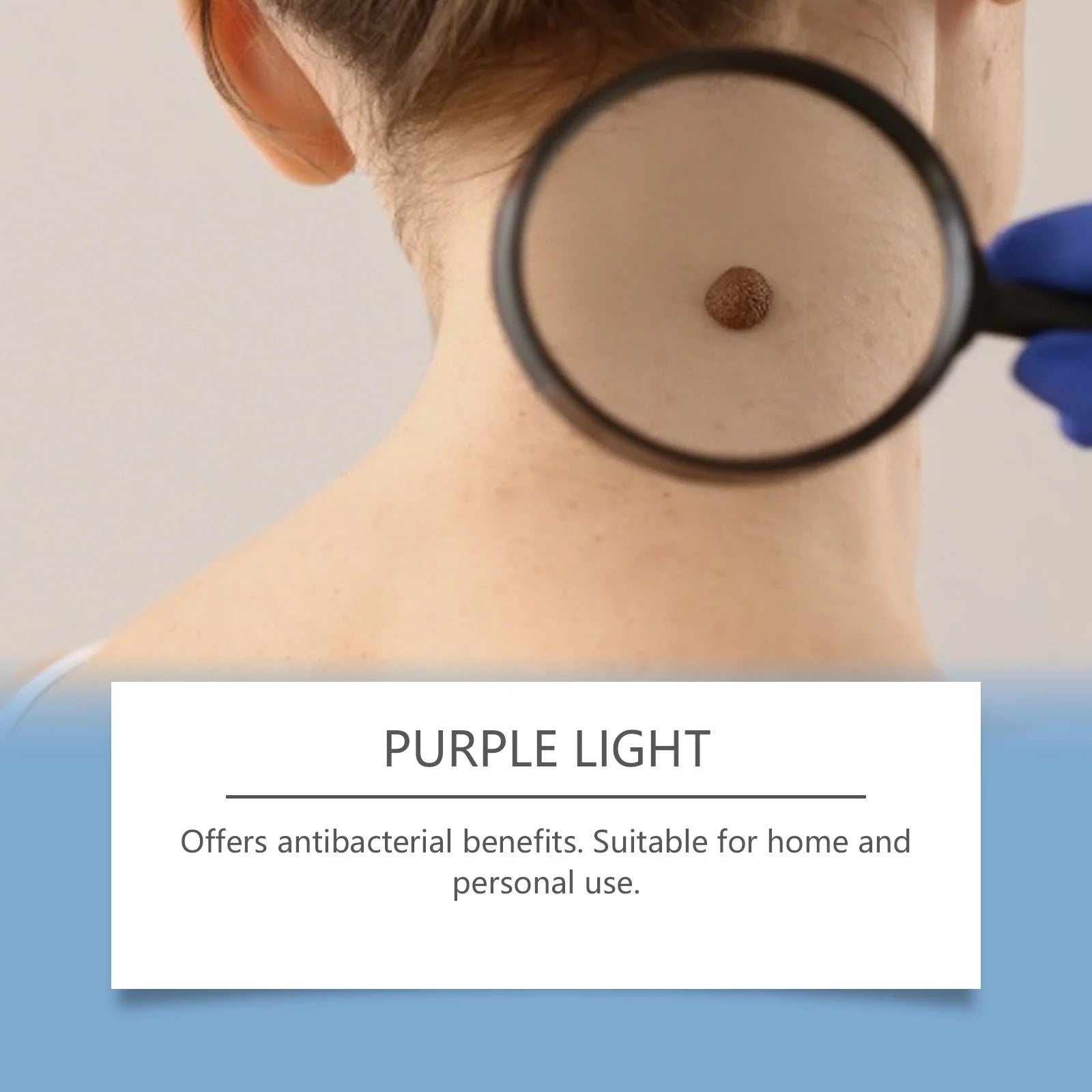 Close-up of skin tag being examined for laser plasma pen removal, highlighting antibacterial purple light treatment.