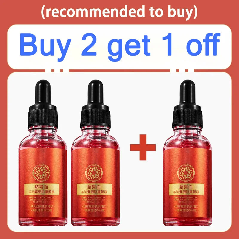 30ml Umbilical Cord Blood Sheep Placenta Serum in dropper bottles for delicate, anti-aging, moisturizing skincare.