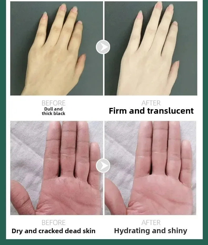 Hand cream for removing wrinkles on finger joints, removing hand wrinkles, and reducing joint roughness and blackness