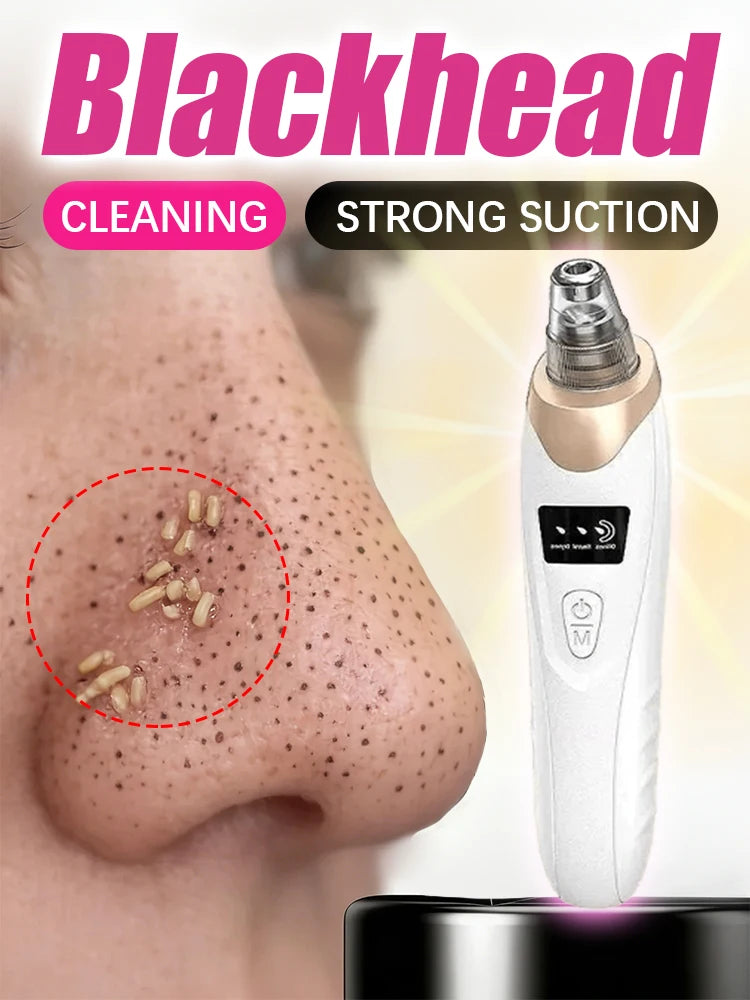 Handheld blackhead vacuum remover tool for deep facial pore cleansing and pimple suction on nose skin.