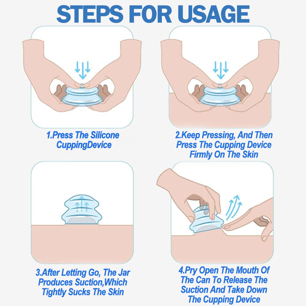 Four-step illustrated guide showing how to use blue silicone vacuum suction cupping jars on skin.