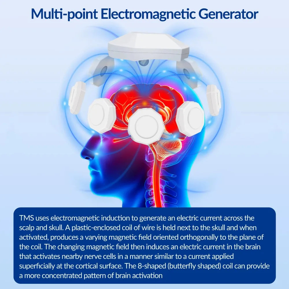 Frovab rTMS brain stimulation device with white multi-point electromagnetic generator nodes for non-invasive therapy.