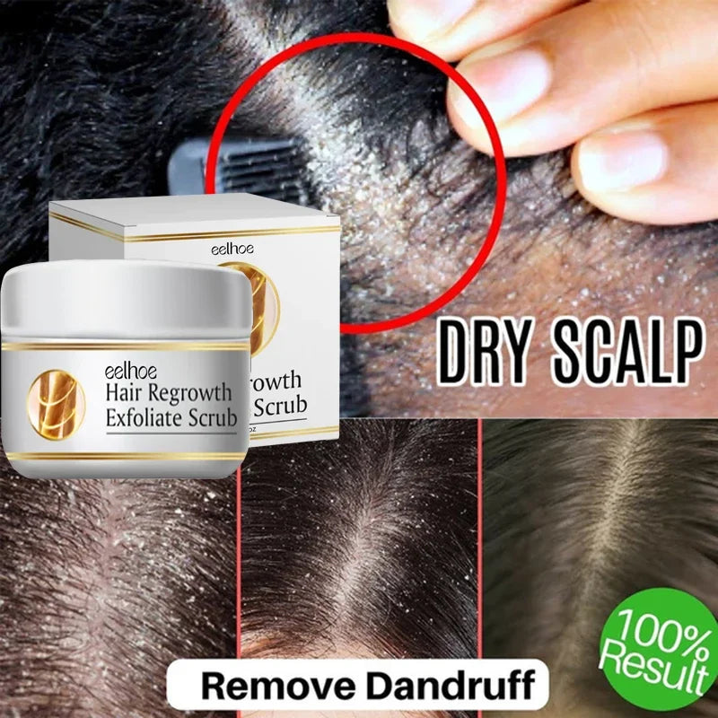Anti Dandruff Scalp Scrub Treatment for Itch Relief - Tidesmit Scrubs Treatments Tidesmit