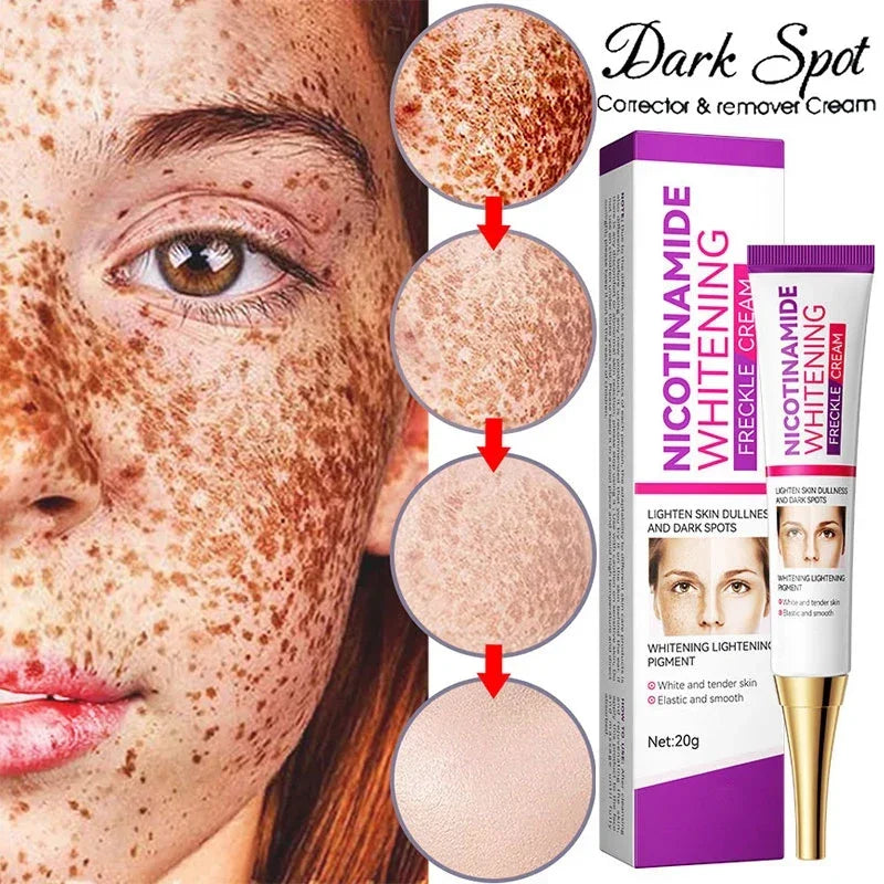 Tidesmit niacinamide melasma lightening cream texture close-up for dark spot removal and brightening face care