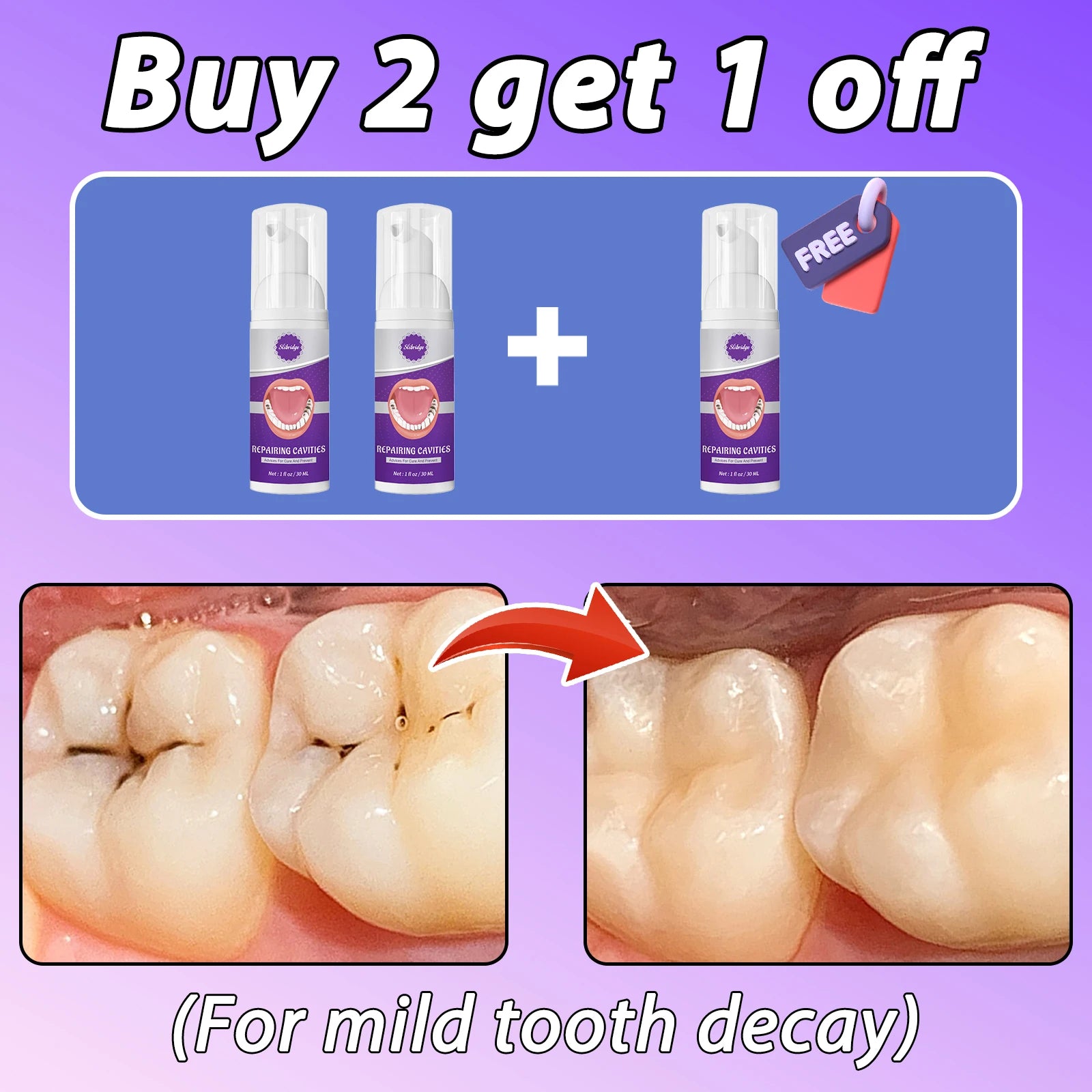 Tidesmit teeth whitening and anti-caries toothpaste for tooth decay repair and cavity protection