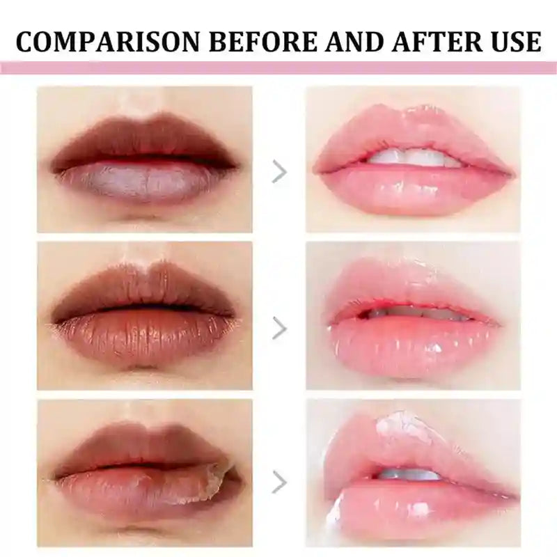 Dark Lip Lightening Balm: Moisturizing Treatment by Tidesmit Lip Care Tidesmit