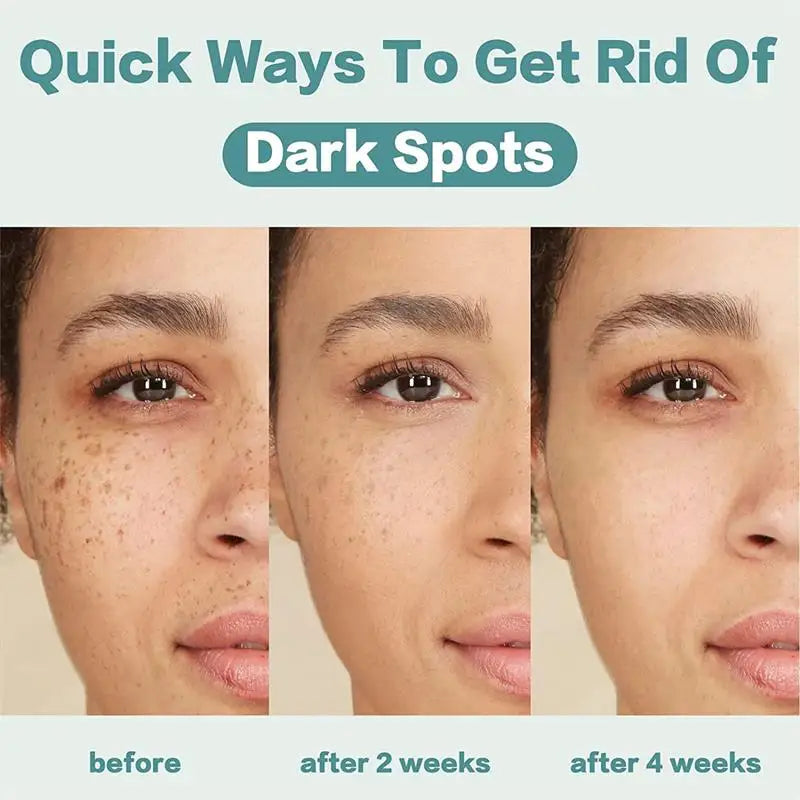 Dark Spot Corrector Cream for Pigmentation & PMU Aftercare | Tidesmit Permanent Makeup Machines Tidesmit
