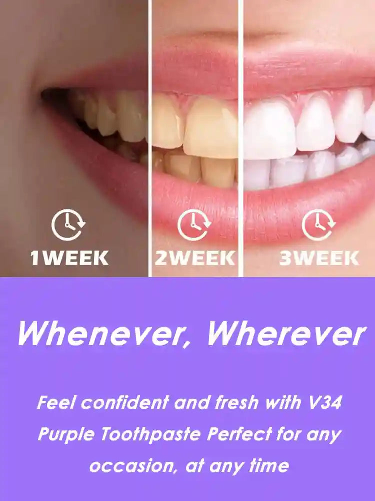 Tidesmit V34 instant teeth whitening toothpaste for deep stain removal and fresh breath oral hygiene.