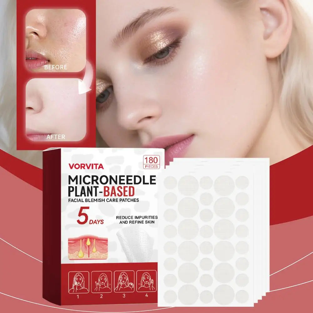 180pcs 0.2mm Facial Soothing Microneedle Patches Acne Care Patch Facial Skin Care Imperfection Patch