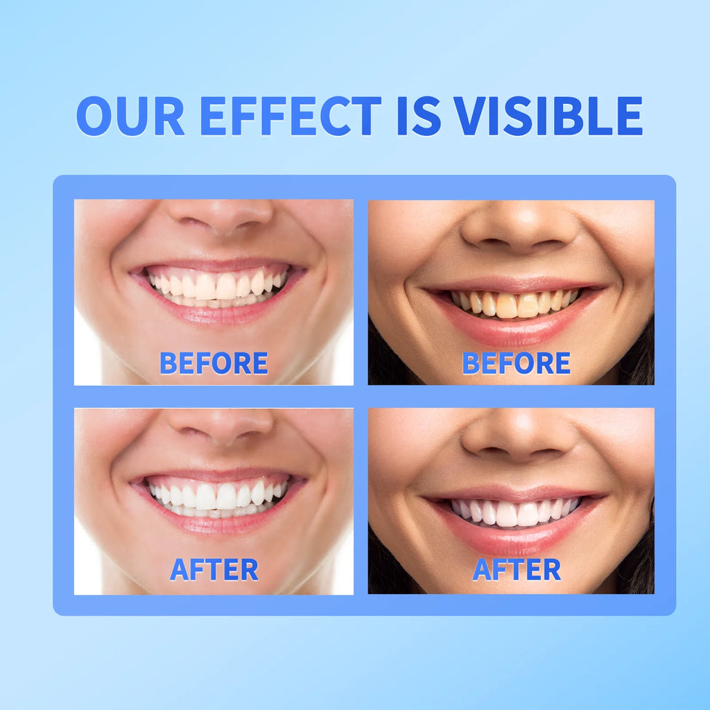 Tidesmit Sp-6/7/10 probiotic brightening toothpaste for effective coffee stain removal and fresh breath