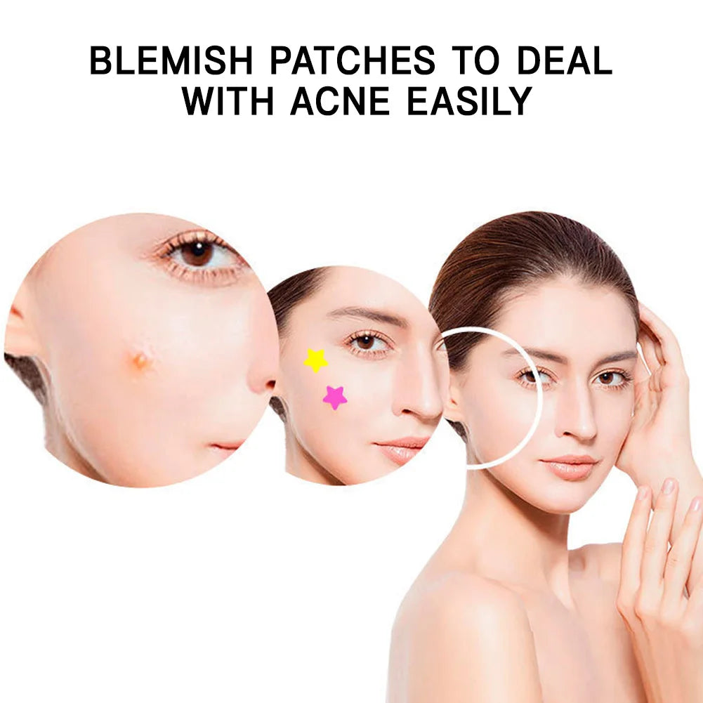 Star Design Pimple Patch with Colorful Makeup Mirror Hydrogel Blemish Concealer Acne Spot Treatment Beauty Health Kit
