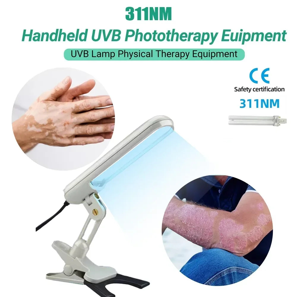 Portable 311nm handheld UVB light therapy lamp for treating vitiligo, psoriasis, and eczema at home.