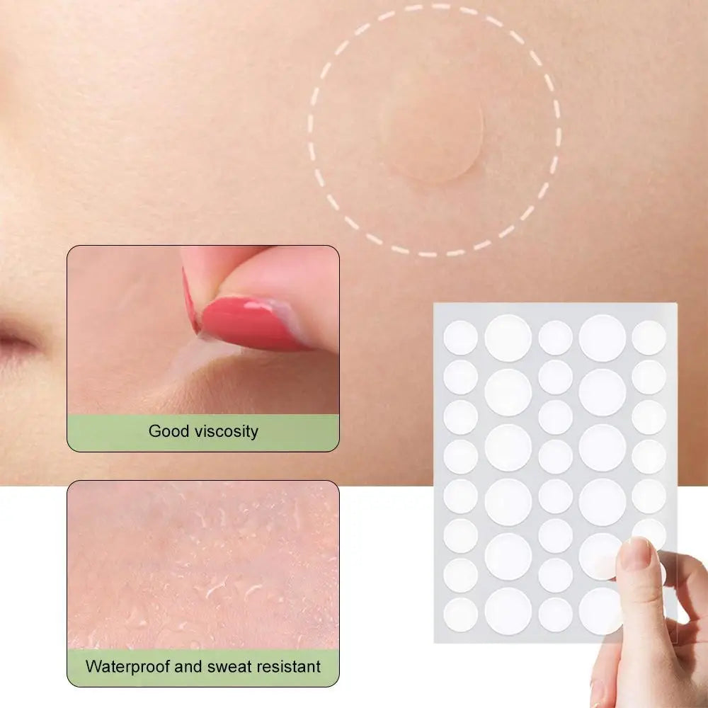Invisible Pimple Patches for Face with Tea Tree Oil, 72/288 Counts Hydrocolloid Acne Pimple Patches Blemish Dots Patch Stickers