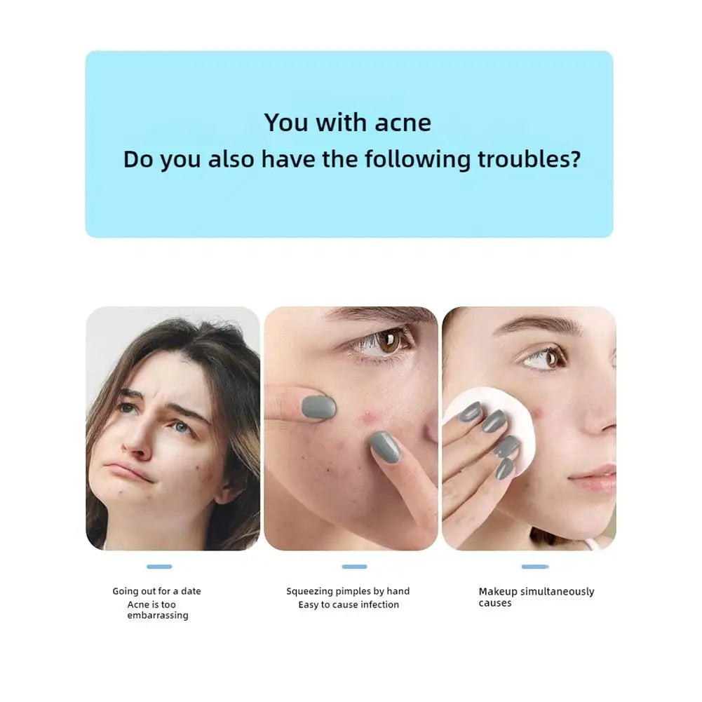Blue/Yellow Stars Hydrocolloid Pimple Patches with Mirror Storage Box,Acne Spot Stickers For Face,Temporary Mirror Makeup Tool