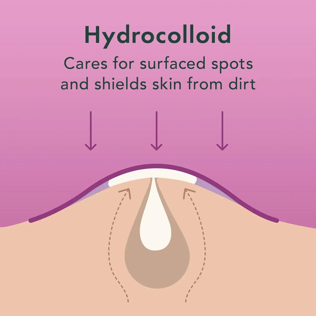 Hydrocolloid Acne Pimple Patches for Face Shrinking Zits Whiteheads Nighttime Spot Pimple Stickers for Face Skin Care Tools