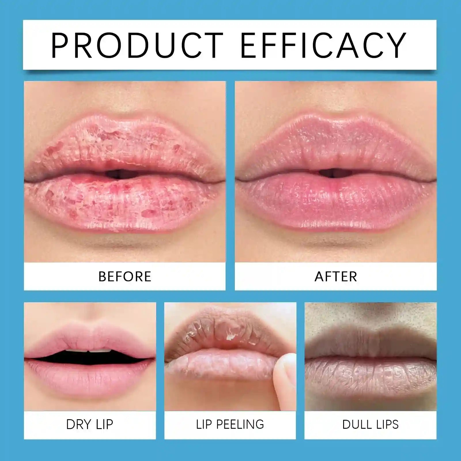 Lip Plumper Serum | Volumizing Lip Treatment for Hydrated Lips Lip Care Tidesmit