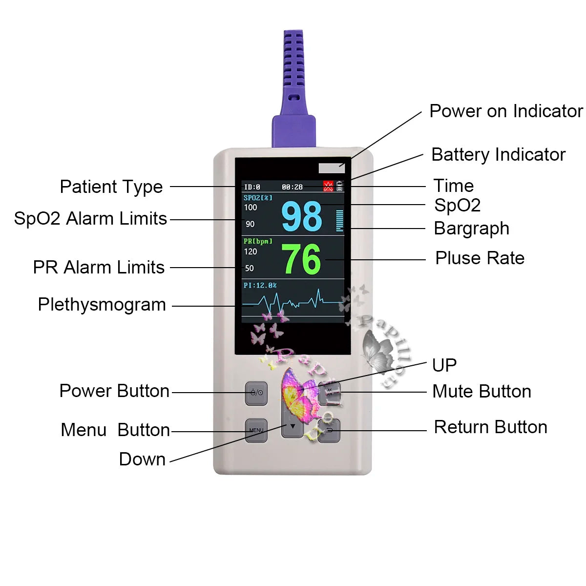 Handheld Pulse Oximeter Veterinary Vital SPO2 PR PI Heart Rate Monitor With Memory Adult Neonatal Pets Hospital Clinic Household