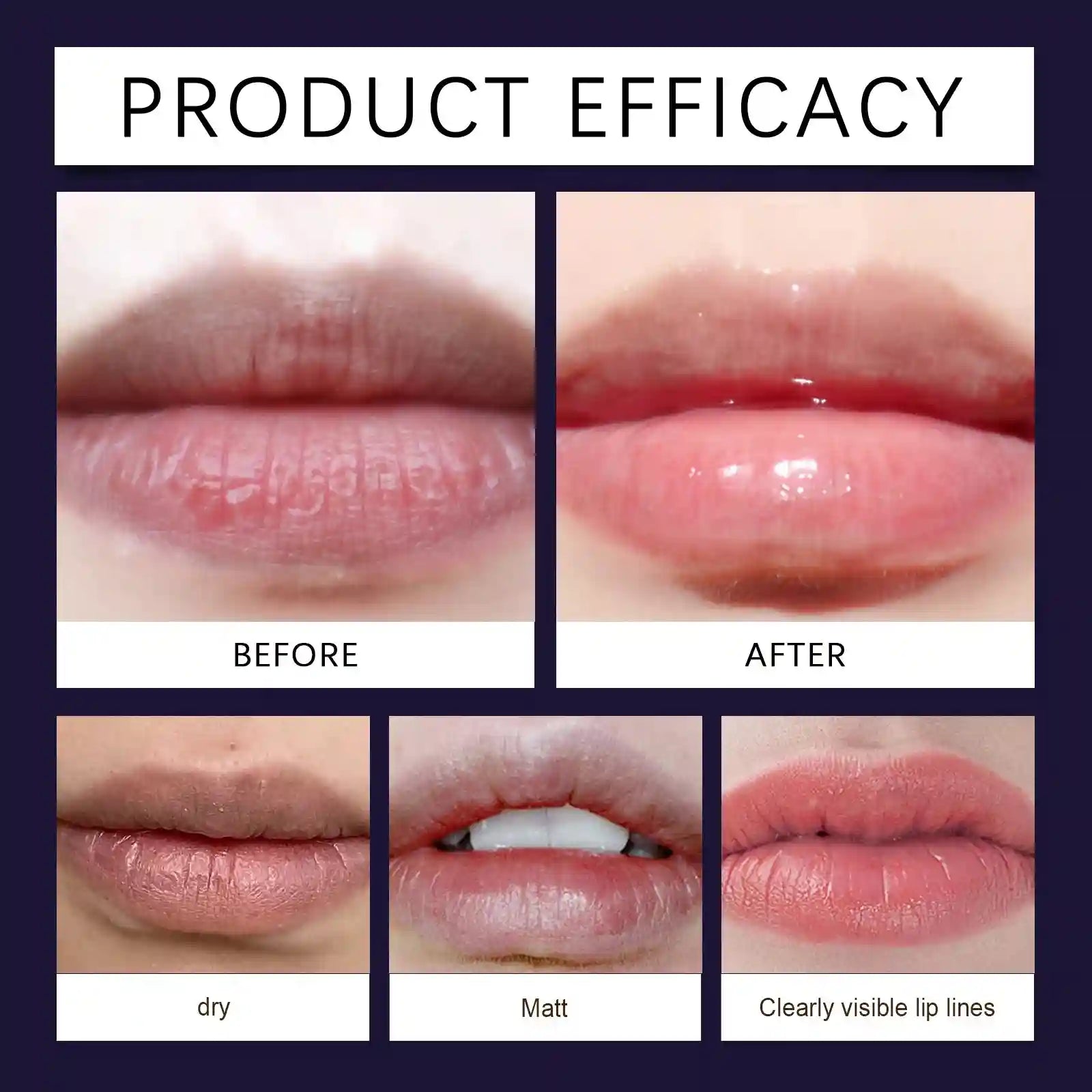 Lip Moisturizing Essence: Hydrating Treatment for Smoother Lips Lip Care Tidesmit