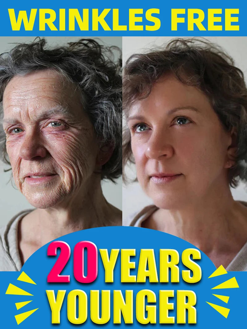 Before and after comparison of a woman showing facial skin with wrinkles on the left and smooth skin on the right.