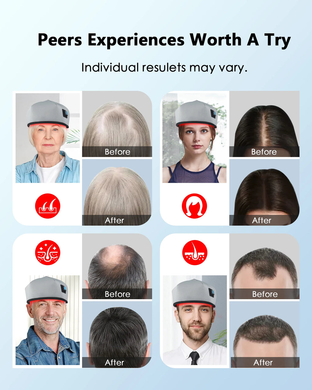 Wired red light therapy hair growth cap showing before and after results for men and women for hair loss treatment.