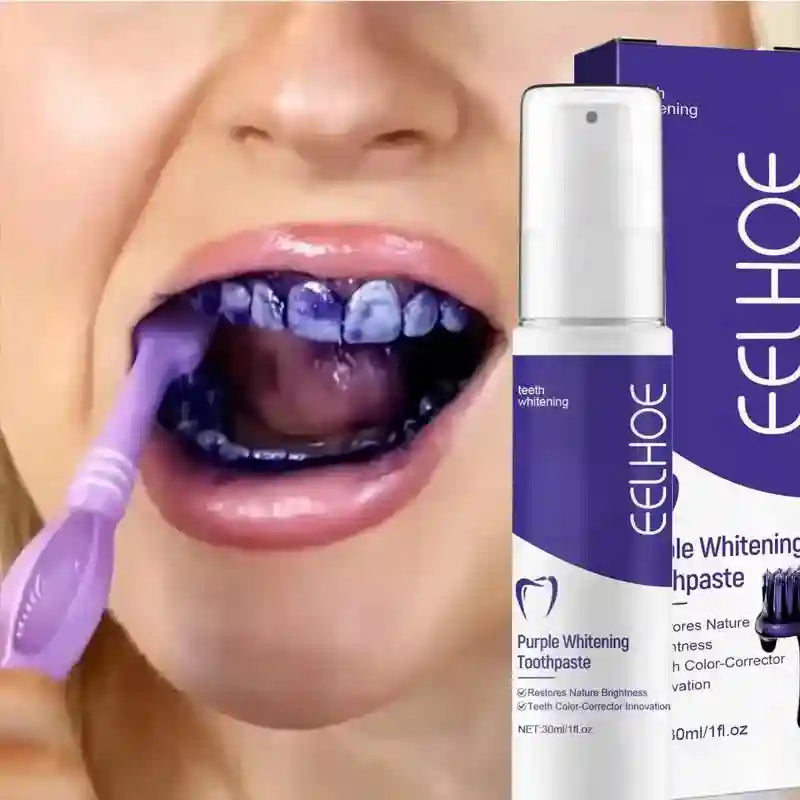 Tidesmit 2026 whitening toothpaste for effective yellow stain removal and daily oral hygiene care