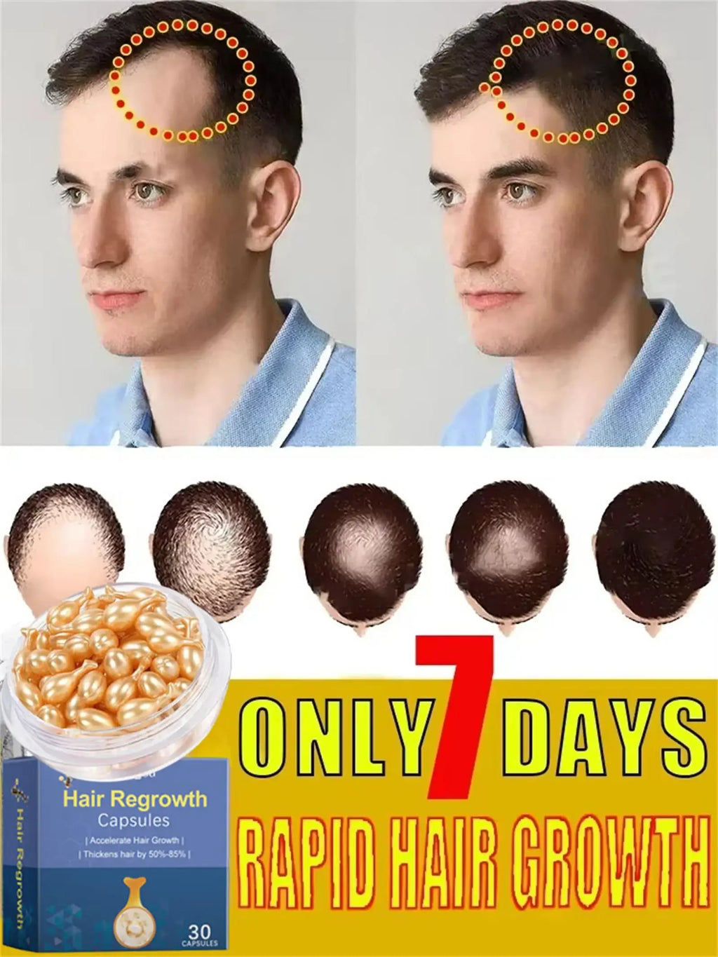 Tidesmit 7-day fast hair growth serum capsules for anti-hair loss, scalp repair, and rapid follicle regrowth treatment.