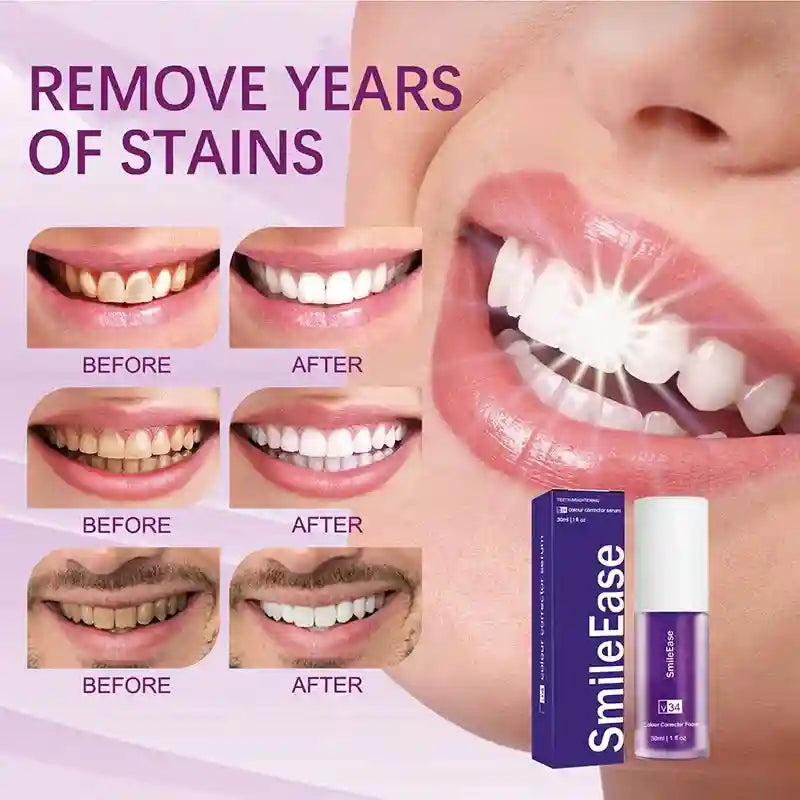 Tidesmit 45ml purple teeth whitening mousse for tartar removal and fresh breath oral hygiene