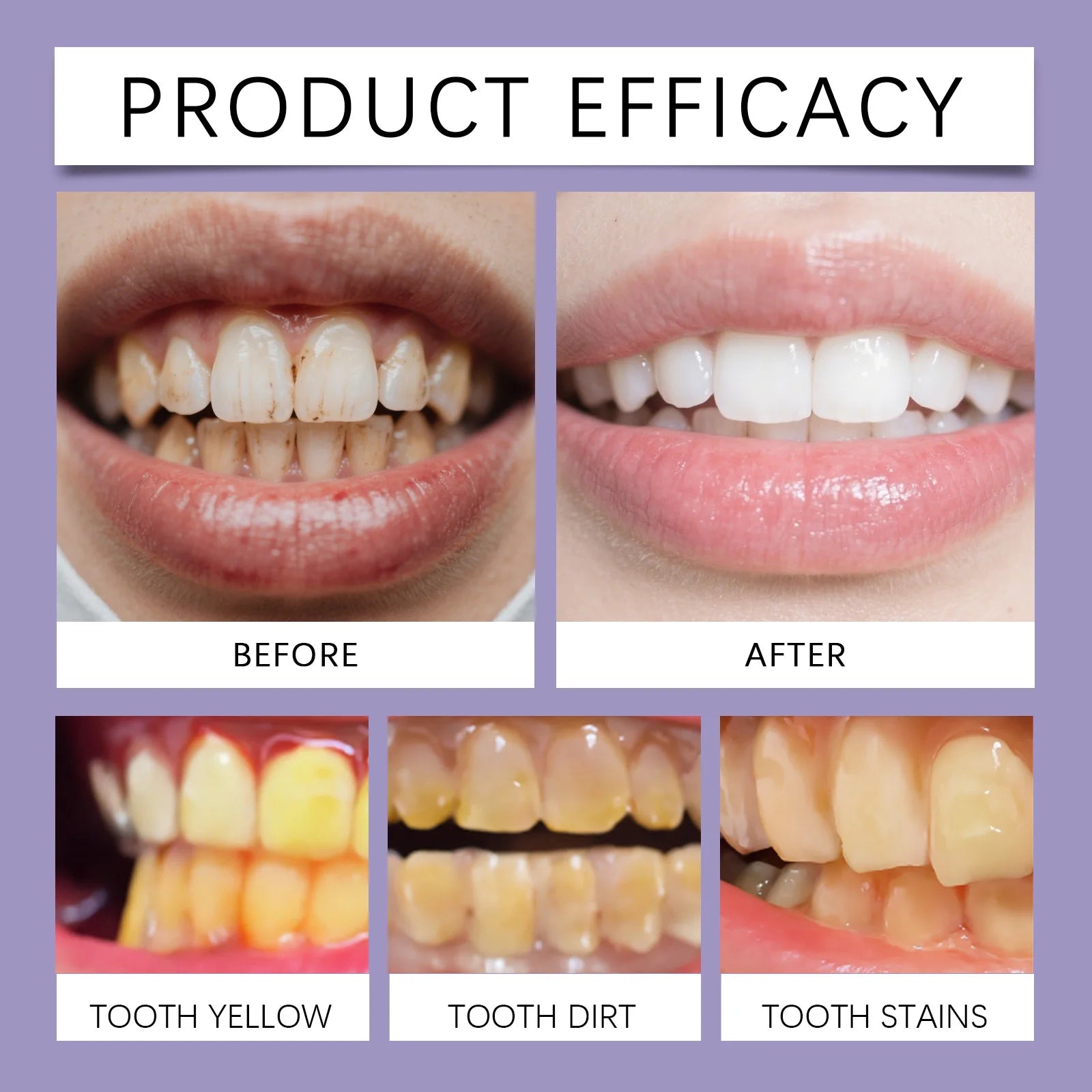 Tidesmit 9D Purple Whitening Foam Toothpaste with 10% Hydroxyapatite for fresh breath and stain removal