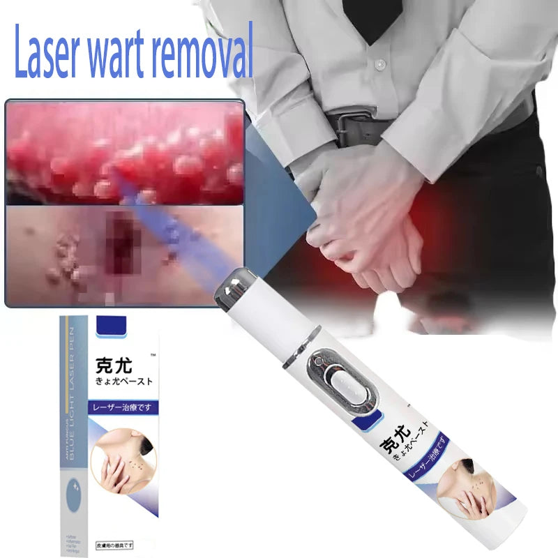 Professional PMU Machine - Precision Skin Tag & Wart Removal Pen Permanent Makeup Machines Tidesmit