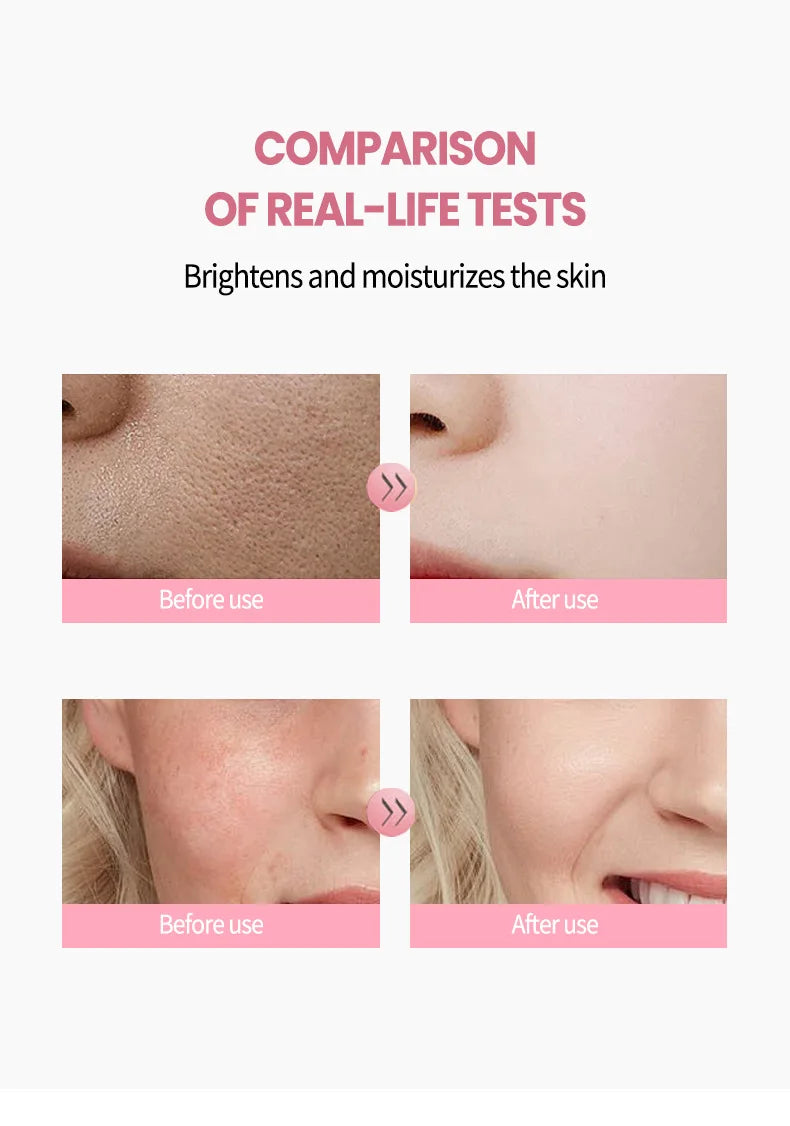 Before and after comparison showing skin texture improvement and reduced redness after using Korean Pink Capsule Cream.