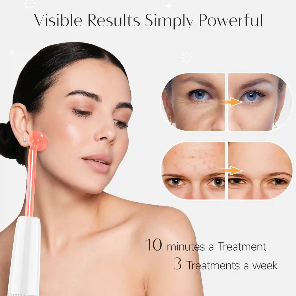 Woman using a neon high-frequency facial wand; includes before-and-after results for wrinkles and acne.