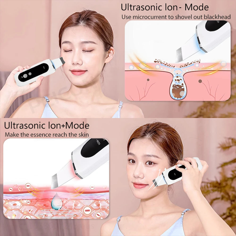 Ultrasonic Skin Scrubber | Professional Facial Cleansing Tool Scrubs Treatments Tidesmit