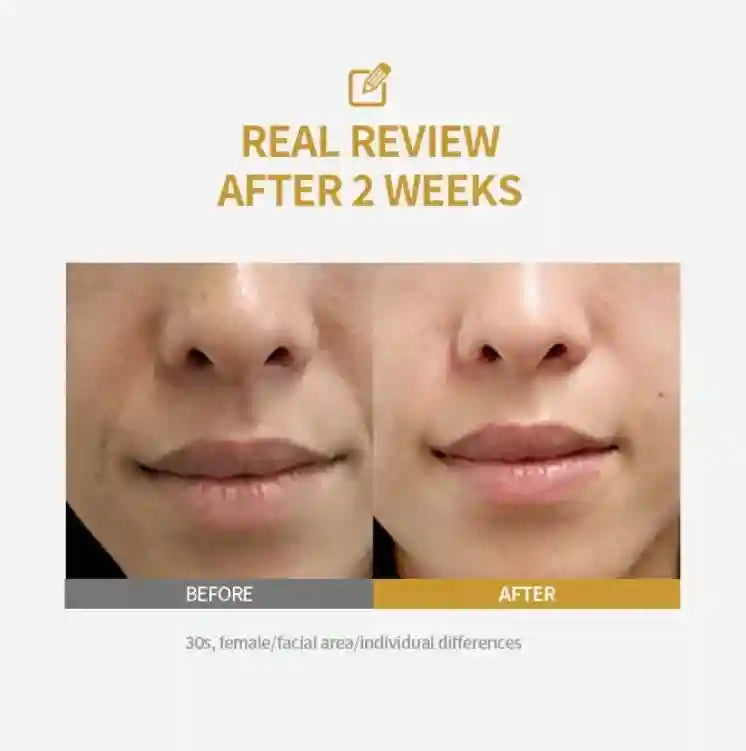 Tidesmit Collagen Peptide Anti-Aging Ampoule and Silk Protein Serum for skin tightening and elasticity boost
