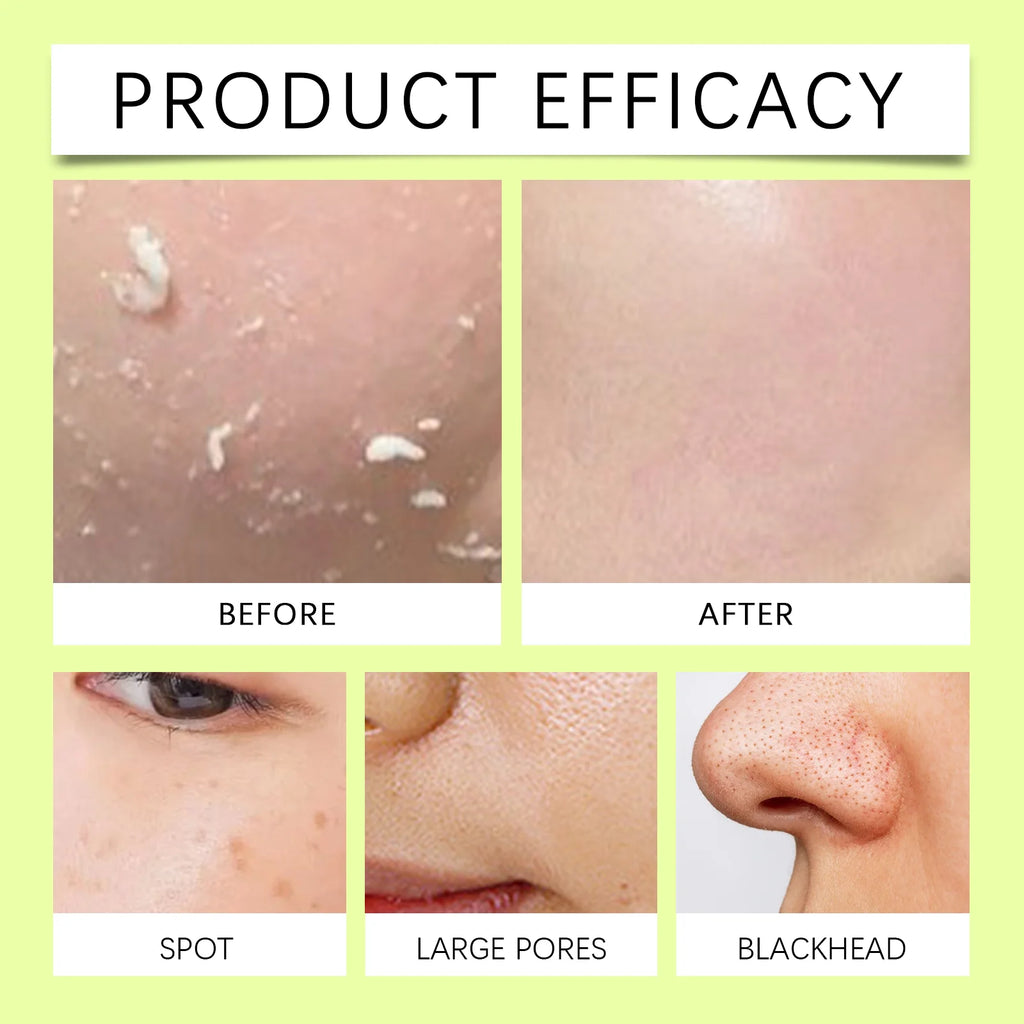 Facial Exfoliating Gel | Hydrating Pore Refining Treatment by Tidesmit Scrubs Treatments Tidesmit
