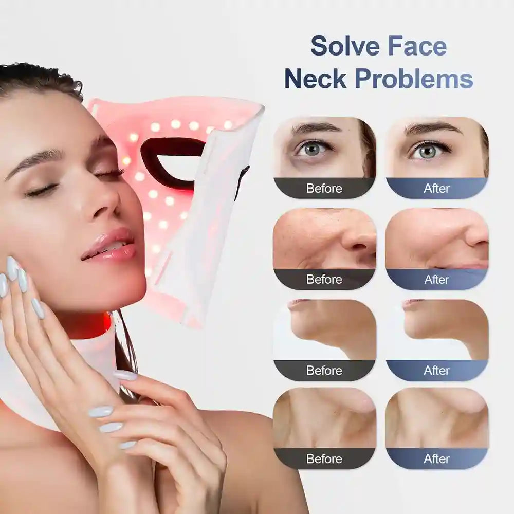 Woman wearing a flexible, translucent white silicone LED face and neck mask emitting red light for skin therapy.