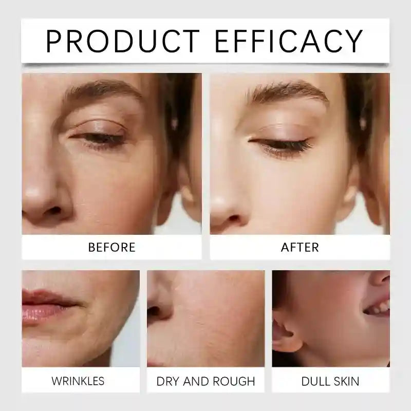 Before-and-after comparison showing skin texture improvement, reduced wrinkles, and more radiant skin tone.