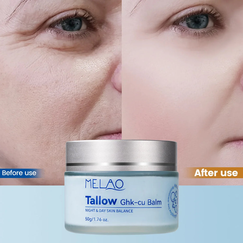 Grass-Fed Blue Balm Moisturizer with GHK-Cu Copper Peptides & Beef Tallow:Calendula Natural Skincare Care for Mature Dry Skin