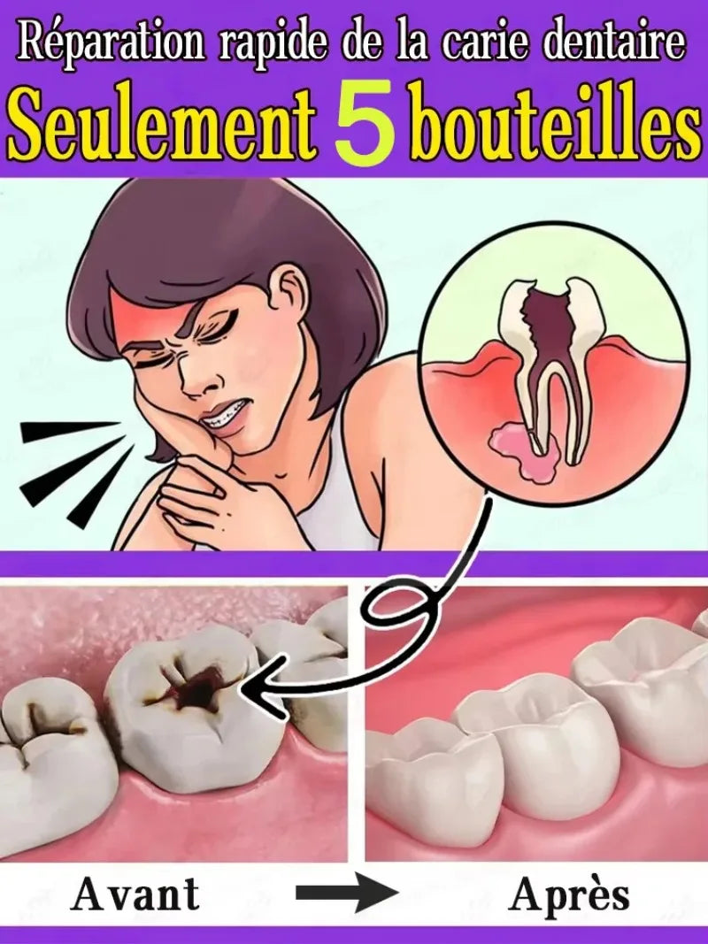 Tidesmit probiotic teeth whitening treatment for repairing tooth decay and deep cleaning enamel