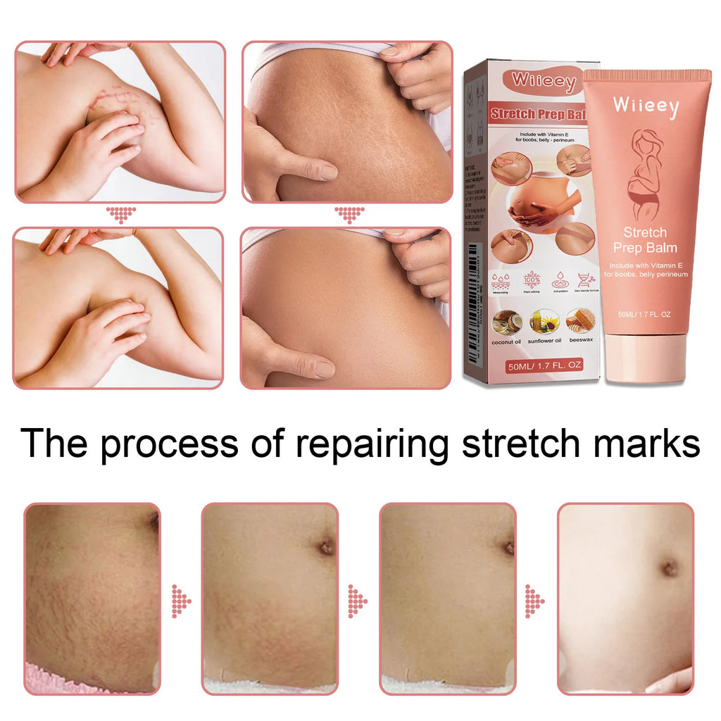 2026 Stretch Mark Removal Cream Permanently Removes Stretch Marks Rejuvenates Skin Stretch Mark Removal Cream.