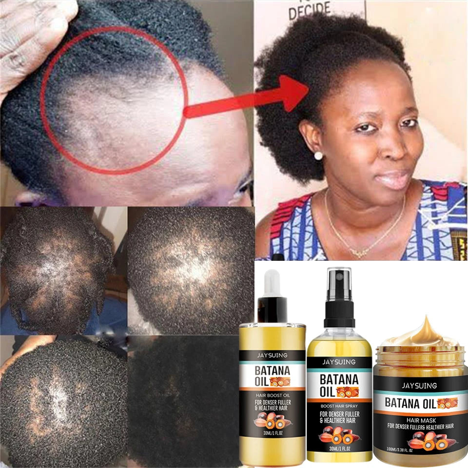Tidesmit Batana Oil hair growth spray and mask treatment for traction alopecia, root repair, and fast hair regrowth.