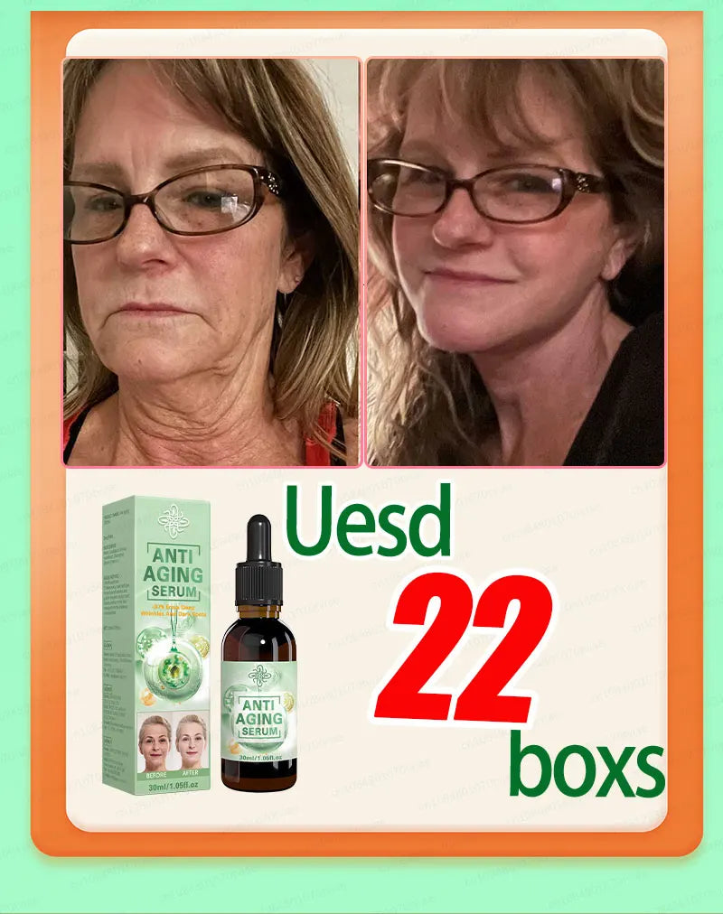 Tidesmit anti-aging serum removes wrinkles and dark spots for youthful skin. Effective collagen face serum before/after.