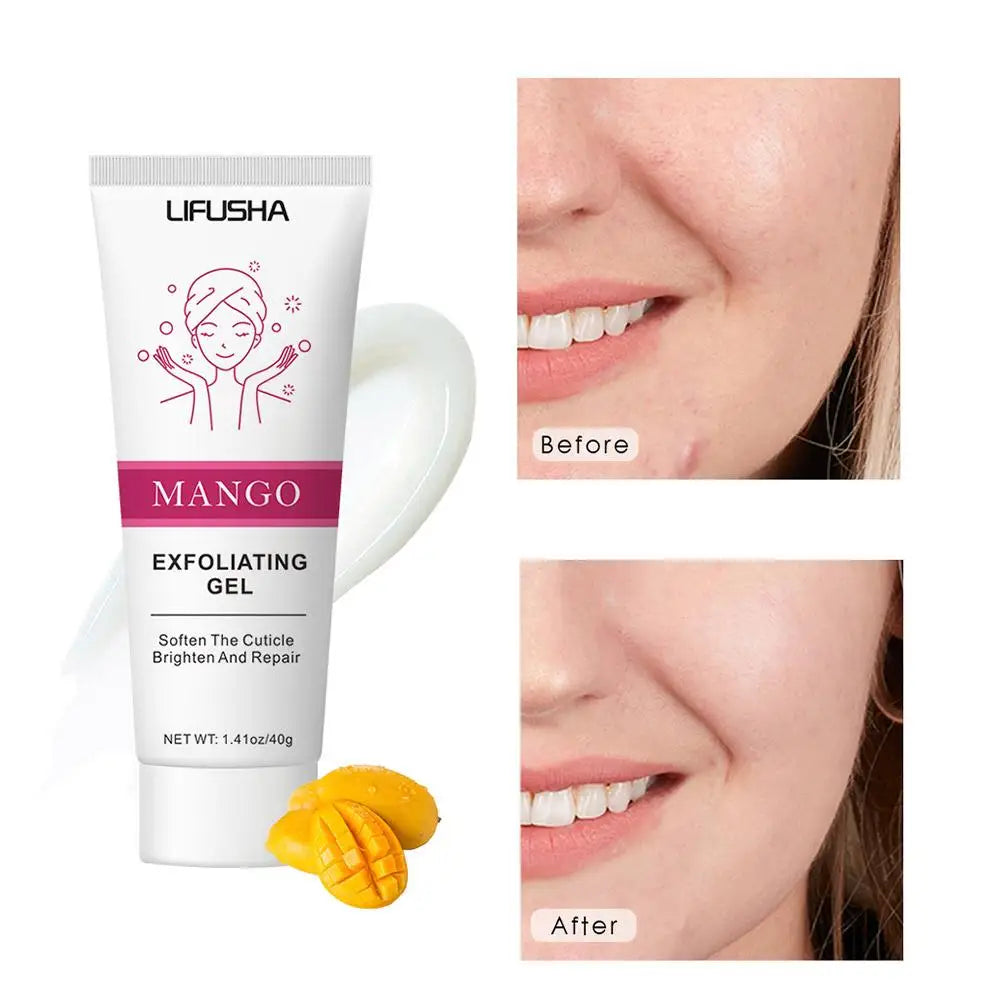 Face Exfoliating Gel for Deep Pore Cleansing and Oil Control - 50g Scrubs Treatments Tidesmit