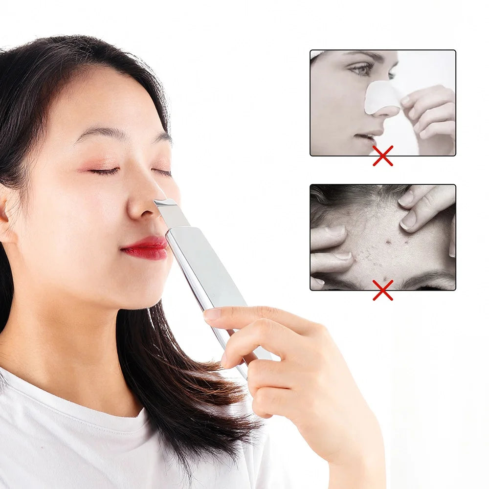 Ultrasonic Facial Skin Scrubber | Professional Deep Cleaning Spatula Scrubs Treatments Tidesmit