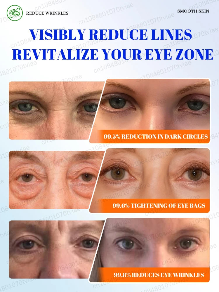Dark Circle Eye Treatment: Portable Massager for Daily Stress Relief Relaxation Treatment Tidesmit
