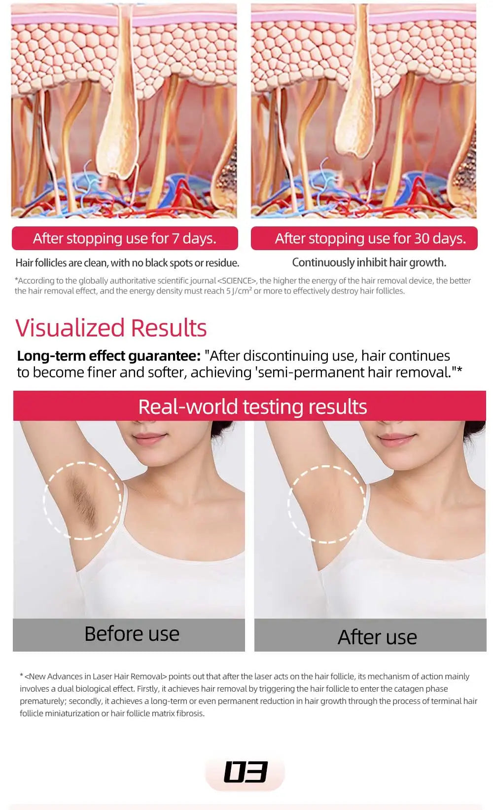 Diagram showing hair follicle reduction after 7 and 30 days, and underarm before and after laser hair removal.