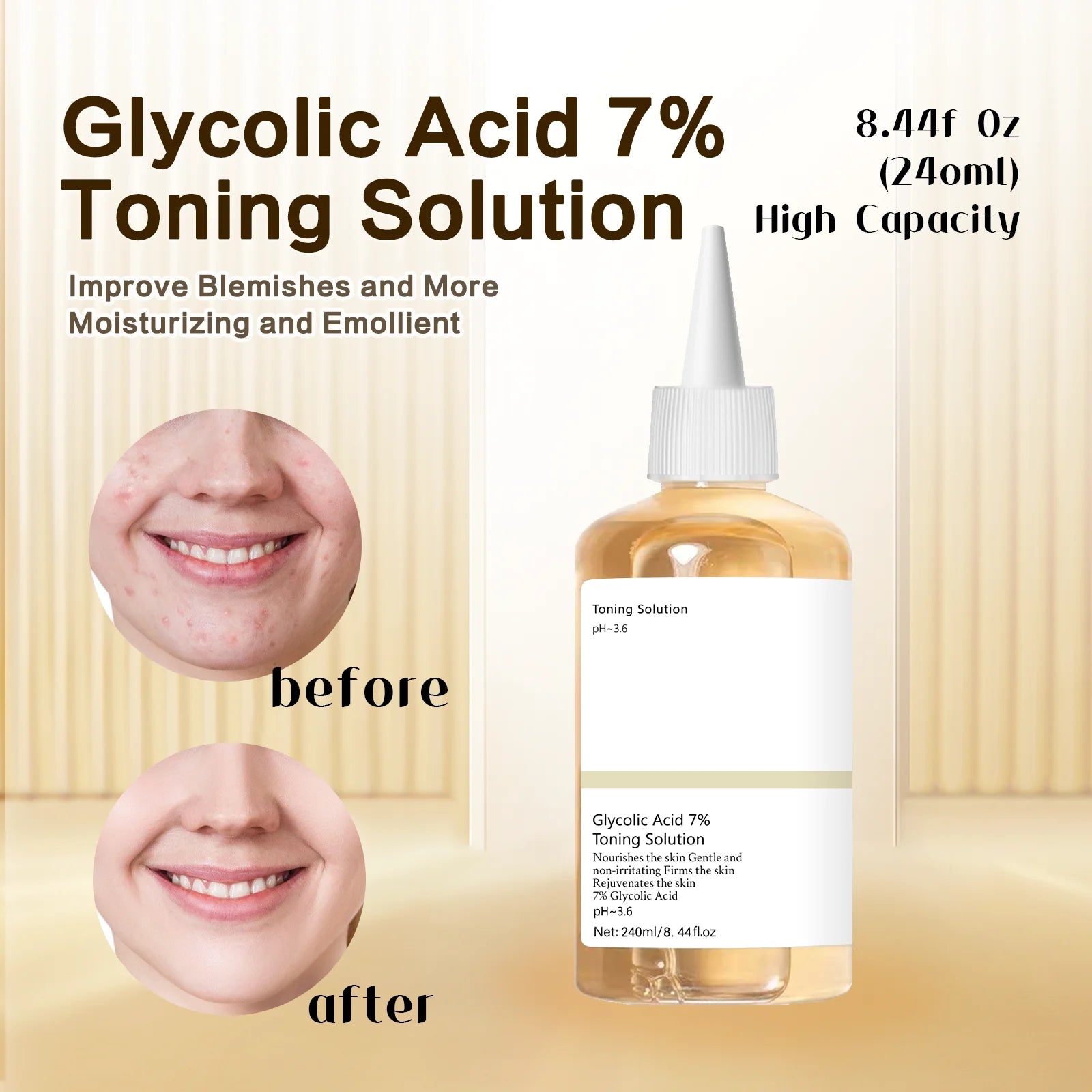 Glycolic Acid 7% Percent Toning Solution Face Exfoliant Acne And Dark Spots Brightens Skin Niacinamide Gentle Facial Care